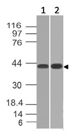 Monoclonal Antibody to TSLP Receptor (Clone: ABM28B6)